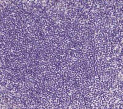 Immunohistochemistry-Paraffin: FDX1 Antibody [NBP1-89227] - Staining of human tonsil shows no positivity in germinal center cells as expected.