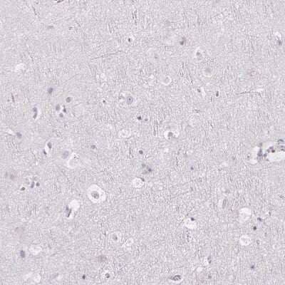 Immunohistochemistry-Paraffin: FDX1 Antibody [NBP2-38946] - Staining of human cerebral cortex shows low expression as expected.