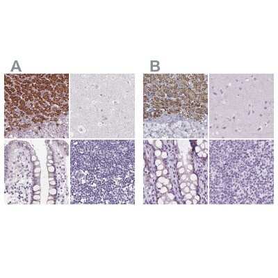 <b>Independent Antibodies Validation and Orthogonal Strategies Validation.</b>Immunohistochemistry-Paraffin: FDX1 Antibody [NBP2-38946] - Staining of human adrenal gland, cerebral cortex, colon and lymph node using Anti-FDX1 antibody NBP2-38946 (A) shows similar protein distribution across tissues to independent antibody NBP1-89227 (B).