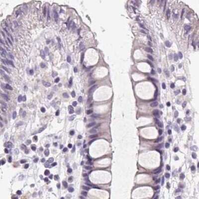 Immunohistochemistry-Paraffin: FDX1 Antibody [NBP2-38946] - Staining of human colon.