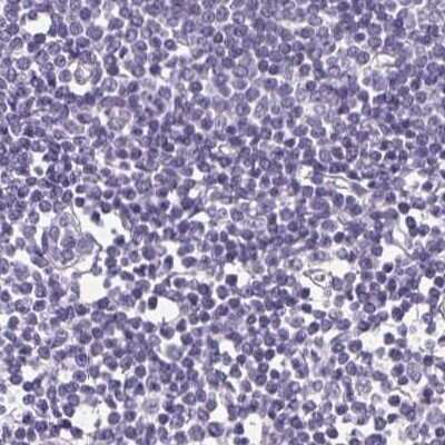 Immunohistochemistry-Paraffin: FDX1 Antibody [NBP2-38946] - Staining of human lymph node.