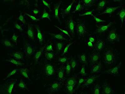 Immunocytochemistry/Immunofluorescence: FE65 Antibody [NBP2-99557] - Immunofluorescence staining of FE65 in HeLa cells. Cells were fixed with 4% PFA, permeabilzed with 0.1% Triton X-100 in PBS, blocked with 10% serum, and incubated with rabbit anti-human FE65 polyclonal antibody (dilution ratio 1:1000) at 4C overnight. Then cells were stained with the Alexa Fluor(R)488-conjugated Goat Anti-rabbit IgG Secondary antibody (green). Positive staining was localized to Nucleus .