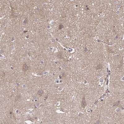 Immunohistochemistry-Paraffin: FE65 Antibody [NBP2-48682] - Staining of human cerebral cortex shows neuropil and cytoplasmic positivity in neurons.