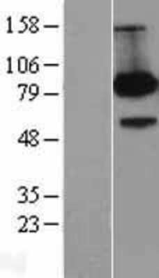 Western Blot: FE65 Overexpression Lysate (Adult Normal) [NBL1-07590] Left-Empty vector transfected control cell lysate (HEK293 cell lysate); Right -Over-expression Lysate for FE65.