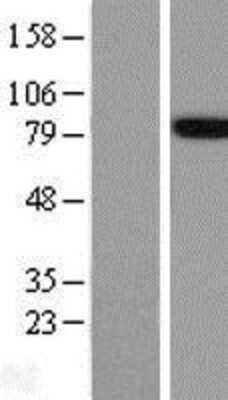 Western Blot: FE65 Overexpression Lysate (Adult Normal) [NBL1-07591] Left-Empty vector transfected control cell lysate (HEK293 cell lysate); Right -Over-expression Lysate for FE65.