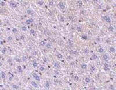 Immunohistochemistry-Paraffin FEM1B Antibody - BSA Free