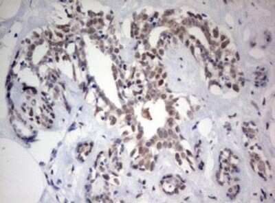 Immunohistochemistry: FEN-1 Antibody (OTI1F3) - Azide and BSA Free [NBP2-70716] - Analysis of Human breast tissue. (Heat-induced epitope retrieval by 10mM citric buffer, pH6.0, 120C for 3min)