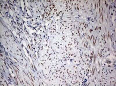 Immunohistochemistry: FEN-1 Antibody (OTI1F3) - Azide and BSA Free [NBP2-70716] - Analysis of Human endometrium tissue. (Heat-induced epitope retrieval by 10mM citric buffer, pH6.0, 120C for 3min)