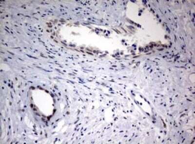 Immunohistochemistry: FEN-1 Antibody (OTI1F3) - Azide and BSA Free [NBP2-70716] - Analysis of Human prostate tissue. (Heat-induced epitope retrieval by 10mM citric buffer, pH6.0, 120C for 3min)