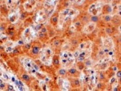 Immunohistochemistry-Paraffin FENS1 Antibody