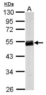 Western Blot: FENS1 Antibody [NBP2-16465] - Sample (50 ug of whole cell lysate) A: Mouse Brain, 10% SDS PAGE gel, diluted at 1:1000.
