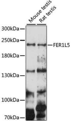 Western Blot: FER1L5 Antibody [NBP3-05642] - Analysis of extracts of various cell lines, using FER1L5 antibody at 1000 dilution.Secondary antibody: HRP Goat Anti-Rabbit IgG (H+L) at 1:10000 dilution.Lysates/proteins: 25ug per lane. Blocking buffer: 3% nonfat dry milk in TBST.Detection: ECL Basic Kit  Exposure time: 150s.