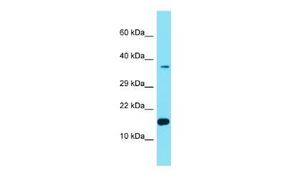 Western Blot: FER1L6-AS2 Antibody [NBP3-09656] - Western blot analysis of FER1L6-AS2 in Hela Whole cell lysates. Antibody dilution at 1.0ug/ml