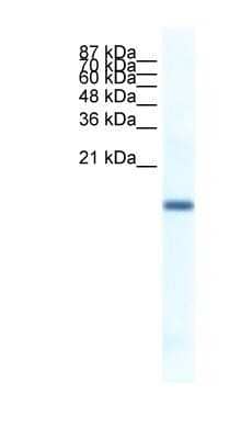 Western Blot: FERD3L Antibody [NBP1-80168] - Titration: 1.0 ug/ml Positive Control: Jurkat Whole Cell.