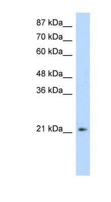 Western Blot: FERD3L Antibody [NBP1-80169] - Jurkat cell lysate, Antibody Titration: 1.0ug/ml