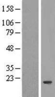 Western Blot: FERD3L Overexpression Lysate (Adult Normal) [NBP2-05303] Left-Empty vector transfected control cell lysate (HEK293 cell lysate); Right -Over-expression Lysate for FERD3L.