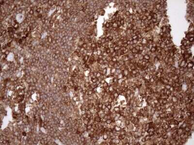 Immunohistochemistry: FERMT3/URP2 Antibody (3C7) [NBP2-45641] - Analysis of Human lymph node tissue. (Heat-induced epitope retrieval by 1mM EDTA in 10mM Tris buffer (pH8.5) at 120C for 3 min)