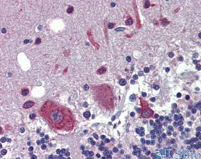 Immunohistochemistry: FEZF1 Antibody [NBP1-91367] - Staining of human pancreas section.