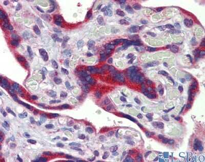 Immunohistochemistry FEZF1 Antibody - BSA Free