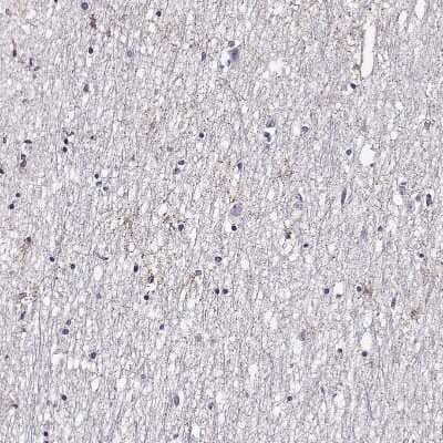 Immunohistochemistry-Paraffin: FEZF1 Antibody [NBP2-57999] - Staining of human hypothalamus shows moderate positivity in processes.