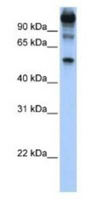 Western Blot FEZF1 Antibody - BSA Free