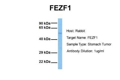 Western Blot FEZF1 Antibody - BSA Free