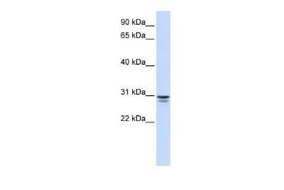 Western Blot: FFAR1/GPR40 Antibody [NBP2-88644] - WB Suggested Anti-FFAR1 Antibody Titration: 0.2-1 ug/ml. ELISA Titer: 1:12500. Positive Control: Human Liver