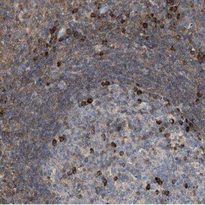 Immunohistochemistry: FGD3 Antibody [NBP2-30845] - Staining of human tonsil shows strong positivity in a subset of leukocytes.