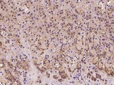 Immunohistochemistry-Paraffin FGD6 Antibody - BSA Free