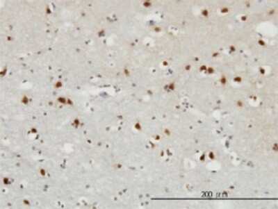 Immunohistochemistry-Paraffin: FGF-12 Antibody (1D9) [H00002257-M10] - Analysis of monoclonal antibody to FGF12 on formalin-fixed paraffin-embedded human cerebral cortex. Antibody concentration 3 ug/ml