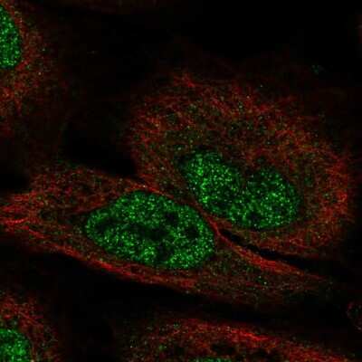 Immunocytochemistry/ Immunofluorescence FGF-12 Antibody - BSA Free
