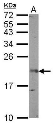 Western Blot: FGF-12 Antibody [NBP2-14956] -  Sample (50 ug of whole cell lysate) A: mouse brain 12% SDS PAGE; antibody diluted at 1:1000.