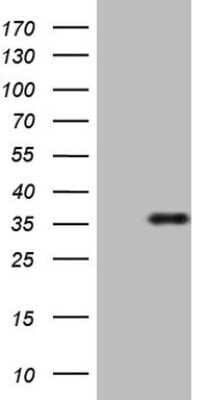 Western Blot: FGF-13 Antibody (OTI7E8) - Azide and BSA Free [NBP2-70721] - Analysis of HEK293T cells were transfected with the pCMV6-ENTRY control (Left lane) or pCMV6-ENTRY FGF-13 .