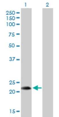 Western Blot: FGF-19 Antibody [H00009965-B02P] - Analysis of FGF19 expression in transfected 293T cell line by FGF19 polyclonal antibody.  Lane 1: FGF19 transfected lysate(23.76 KDa). Lane 2: Non-transfected lysate.