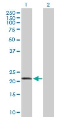 Western Blot: FGF-19 Antibody [H00009965-D01P] - Analysis of FGF19 expression in transfected 293T cell line by FGF19 polyclonal antibody.Lane 1: FGF19 transfected lysate(24.00 KDa).Lane 2: Non-transfected lysate.