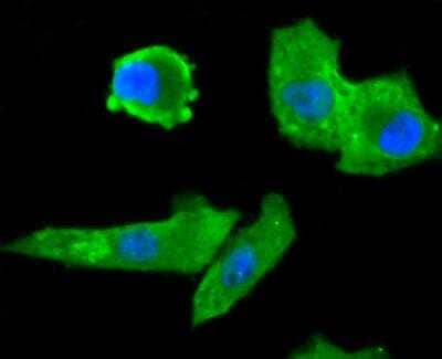 Immunocytochemistry/Immunofluorescence: FGF-21 Antibody (AH21-71) [NBP2-67275] - Staining FGF21 in A549 cells (green). The nuclear counter stain is DAPI (blue). Cells were fixed in paraformaldehyde, permeabilised with 0.25% Triton X100/PBS.
