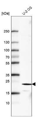 Western Blot: FGF-21 Antibody (CL6491) [NBP2-76496] - Analysis in human cell line U-2 OS.