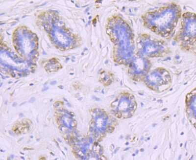 Immunohistochemistry-Paraffin: FGF-21 Antibody (JA10-97) [NBP2-66841] - Analysis of paraffin-embedded human brest tissue using anti-FGF21 antibody. Counter stained with hematoxylin.
