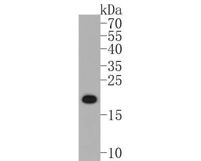 Western Blot: FGF-21 Antibody (JA10-97) [NBP2-66841] - Western blot analysis of FGF-21 on human liver tissue lysates. Proteins were transferred to a PVDF membrane and blocked with 5% BSA in PBS for 1 hour at room temperature. The primary antibody (1/500) was used in 5% BSA at room temperature for 2 hours. Goat Anti-Rabbit IgG - HRP Secondary Antibody (HA1001) at 1:5,000 dilution was used for 1 hour at room temperature.
