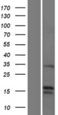 Western Blot FGF-22 Overexpression Lysate