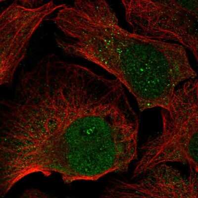 Immunocytochemistry/Immunofluorescence: FGF-5 Antibody [NBP2-59013] - Staining of human cell line U-2 OS shows localization to nucleus & nucleoli fibrillar center.