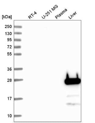 Western Blot: FGF-5 Antibody [NBP2-59013] - Analysis in human cell line RT-4, human cell line U-251 MG, human plasma and human liver tissue.