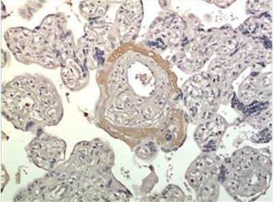 Immunohistochemistry-Paraffin: FGF-9 Antibody (MM0292-4D25) [NBP2-12306] - 10% Buffer formalin fixed and parffine embedded human placetal tissue section (4um) is subjected IHC staining using NBP2-12306. Tissue section was pretreated in citric buffer (pH 6.0) with microwave for antige retrieval before IHC is applied.  