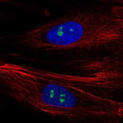 Immunocytochemistry/Immunofluorescence: FGF R1 Antibody [NBP2-56354] - Staining of human cell line BJ shows localization to nucleoli.