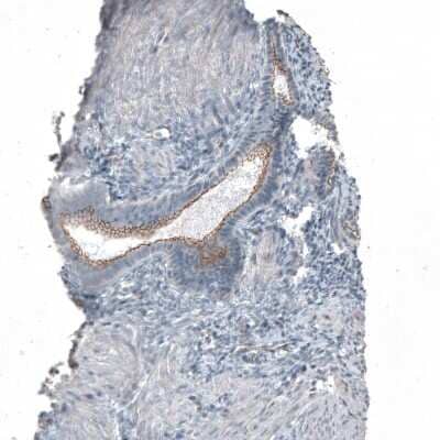 Immunohistochemistry-Paraffin: FGF R2 Antibody [NBP1-88670] - Staining of human endometrium shows moderate membranous positivity in glandular cells.