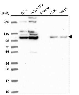 Western Blot: FGF R2 Antibody [NBP2-56776] - Western blot analysis in human cell line RT-4, human cell line U-251 MG, human plasma, human liver tissue and human tonsil tissue.