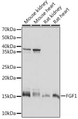 Western Blot: FGF acidic/FGF1 Antibody (3X3E5) [NBP3-16609] - Western blot analysis of extracts of various cell lines, using FGF acidic/FGF1 Rabbit mAb (NBP3-16609) at 1:1000 dilution. Secondary antibody: HRP Goat Anti-Rabbit IgG (H+L) at 1:10000 dilution. Lysates/proteins: 25ug per lane. Blocking buffer: 3% nonfat dry milk in TBST. Detection: ECL Basic Kit. Exposure time: 10s.