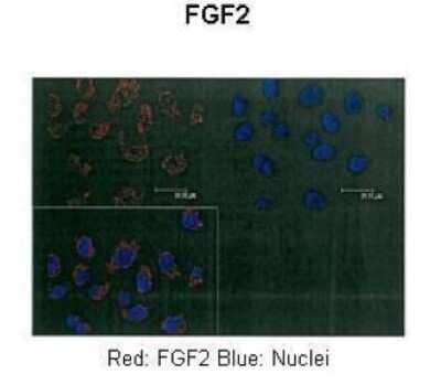 Immunohistochemistry: FGF basic/FGF2 Antibody [NBP1-57096] - Human A375 cells Primary Antibody Dilution: 1 : 100 Secondary Antibody: Anti-rabbit-Alexa-546 Secondary Antibody Dilution: 1 : 100Color/Signal Descriptions: Red: FGF2 Blue: Nuclei.