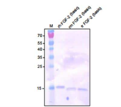 Western Blot: FGF basic/FGF2 Antibody [NBP1-18579] - Analysis of recombinant human, mouse and rat FGF-2 (basic) using a polyclonal antibody directed against recombinant human FGF-2. As expected the antibody cross reacts with the mouse and rat proteins.