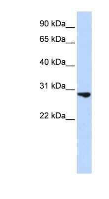 Western Blot: FGF basic/FGF2 Antibody [NBP1-57096] - Jurkat cell lysate, concentration 0.2-1 ug/ml.